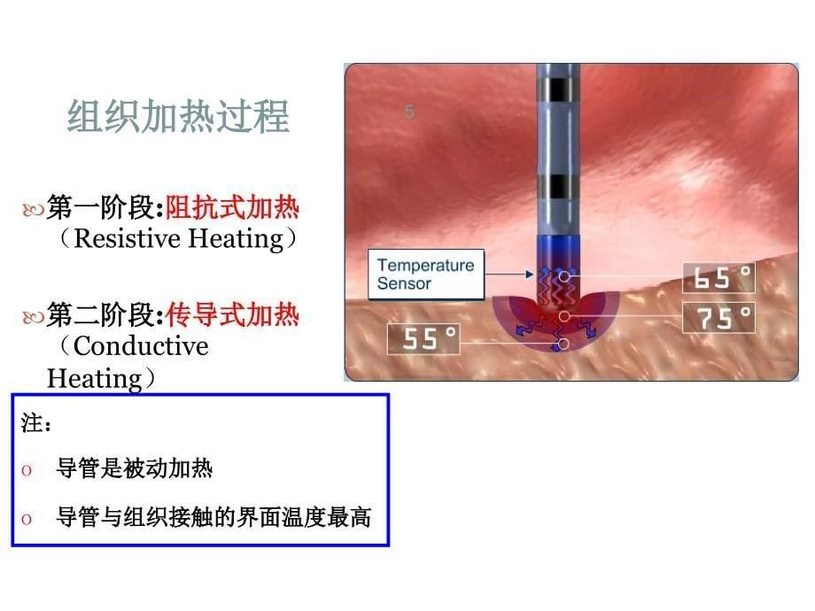 射频消融原理ppt课件_第5页