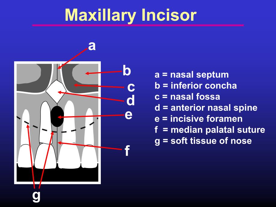 Intraoral Radiographic Anatomy(口内X线解剖)_第2页