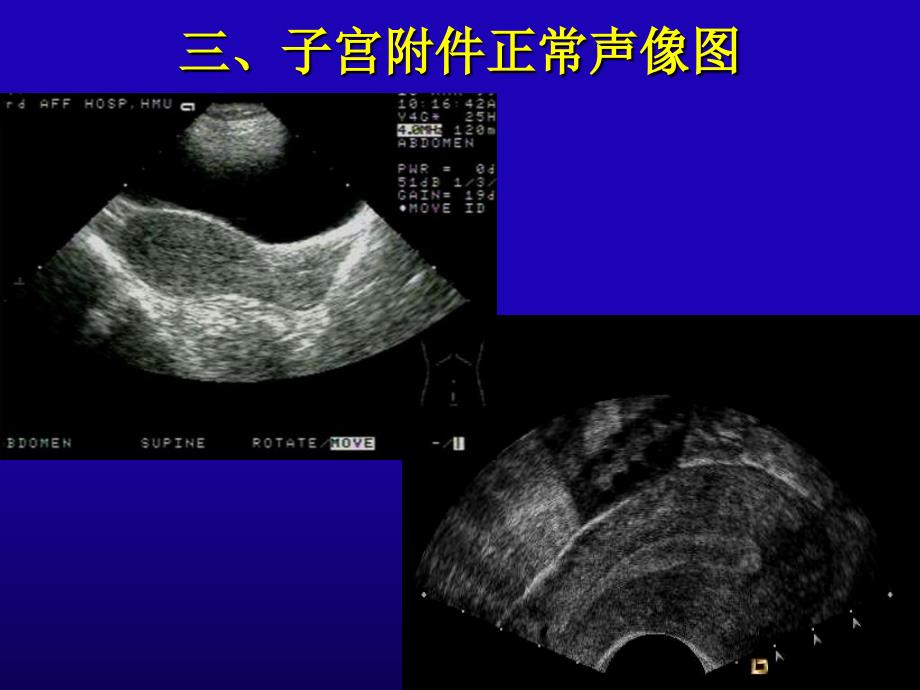 妇产科超声口腔本科PPT文档资料_第3页