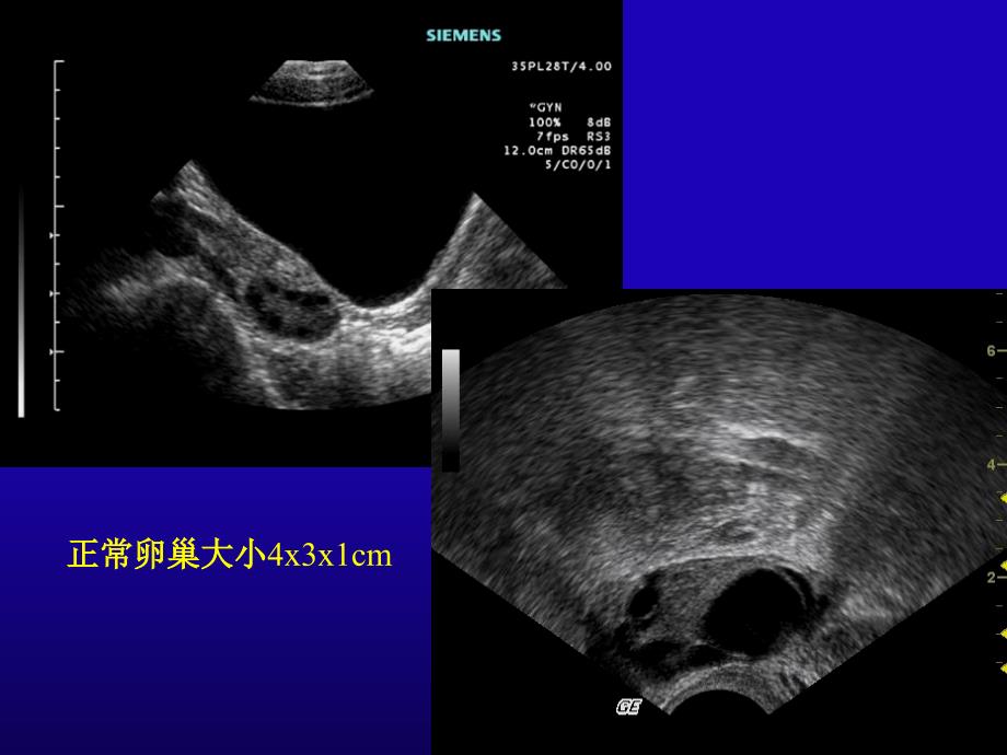 妇产科超声口腔本科PPT文档资料_第4页