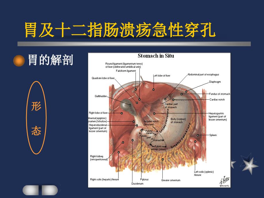 胃及十二指肠溃疡急性穿孔护理查房_第3页