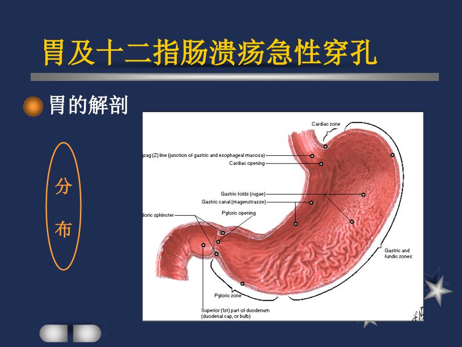 胃及十二指肠溃疡急性穿孔护理查房_第4页