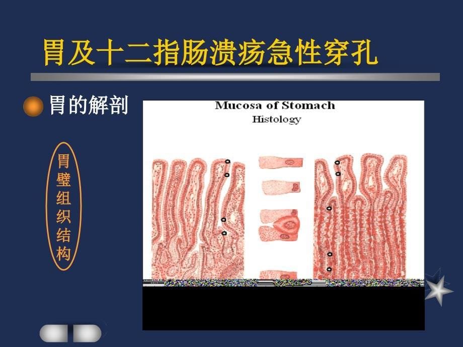 胃及十二指肠溃疡急性穿孔护理查房_第5页