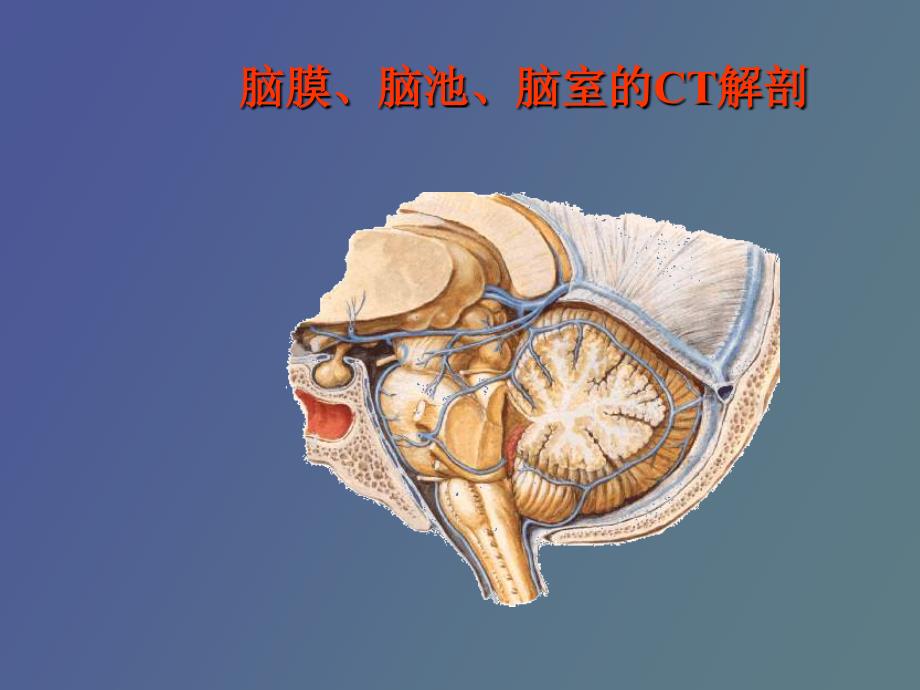 脑膜脑池脑室的CT解剖_第1页