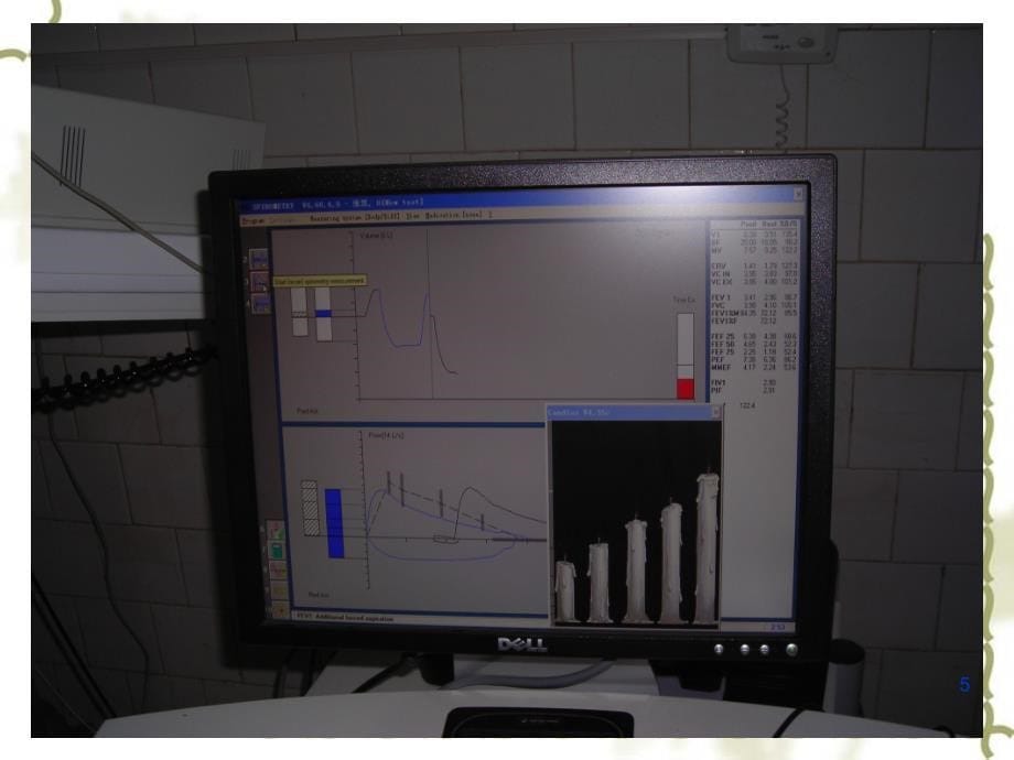 肺功能的测定和临床应用ppt课件_第5页