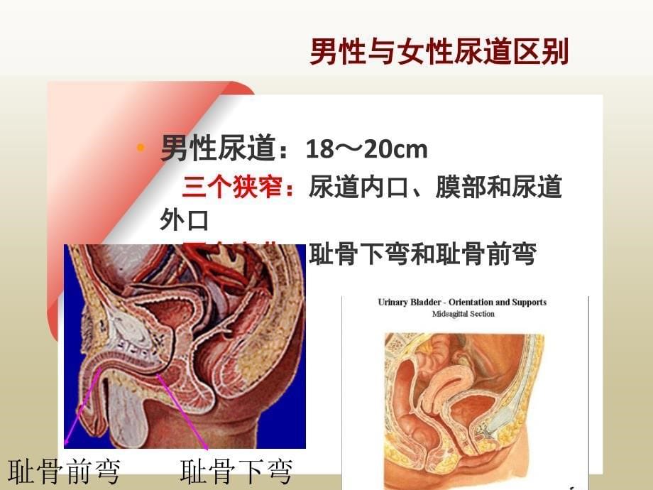 手术室导尿术课件_第5页