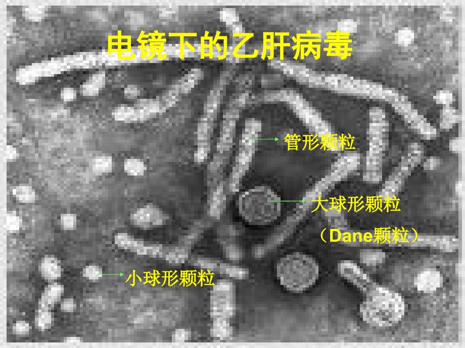 乙肝病毒化验单及预防治疗文档资料_第4页