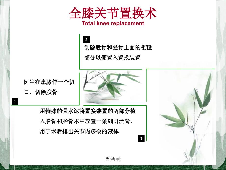 全膝关节置换术后护理PPT_第4页