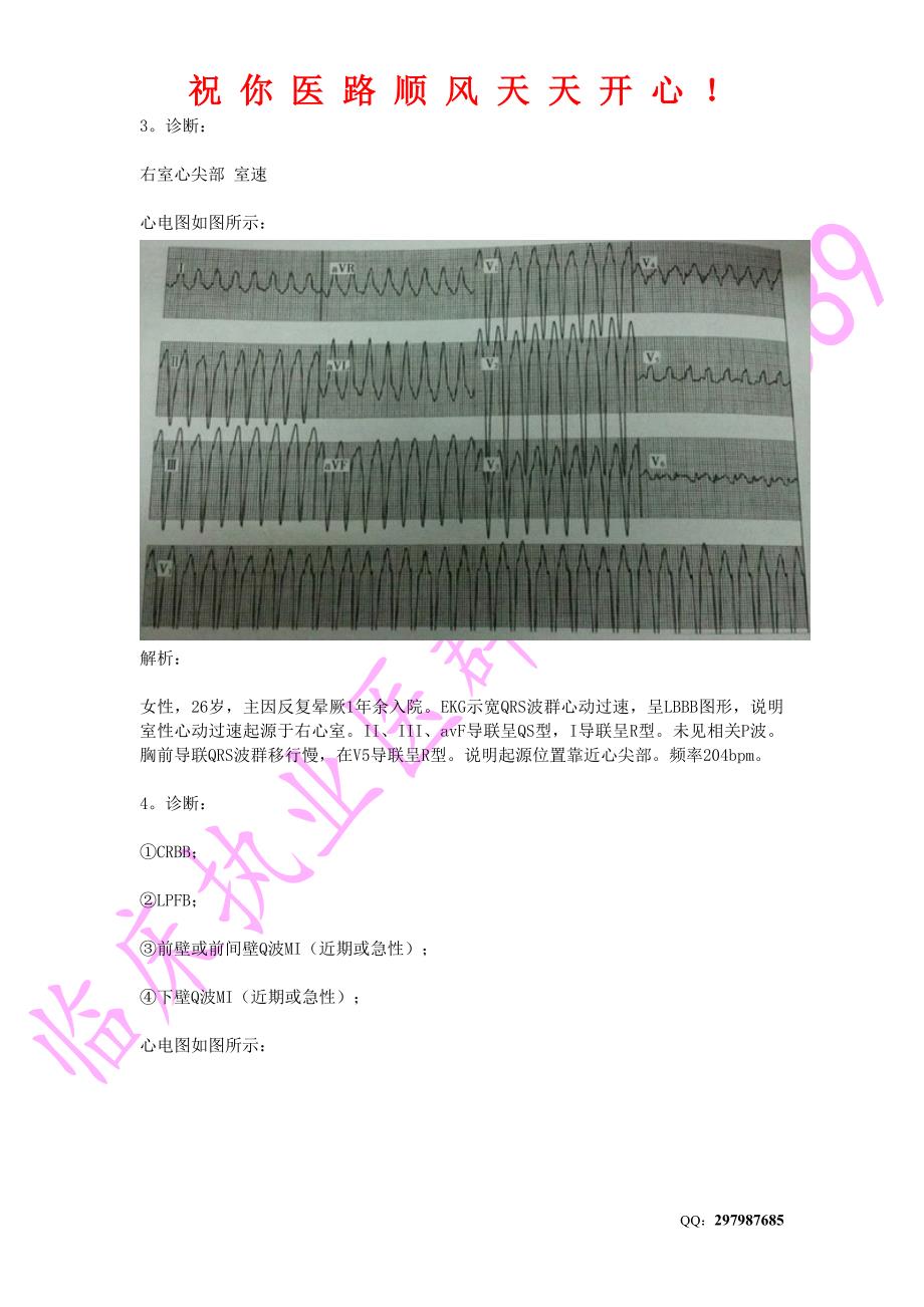 20个心电图解析+记忆技巧 (2).doc_第3页