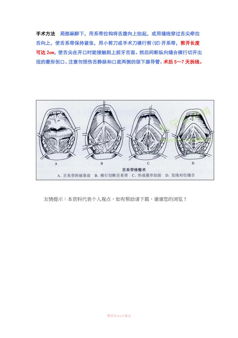 唇(舌)系带修整术_第2页