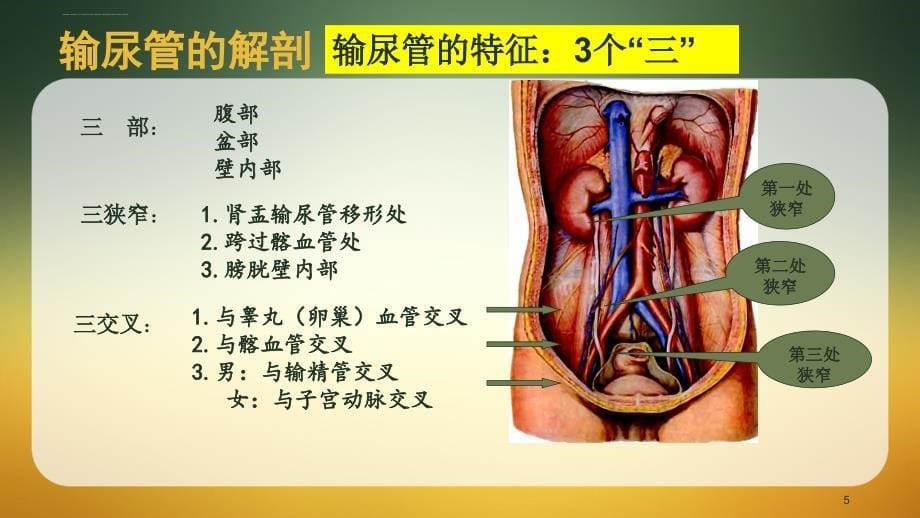 后腹腔镜下输尿管切开取石术ppt课件_第5页