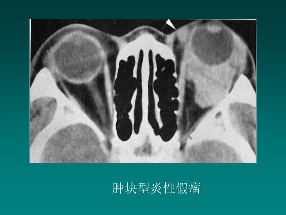 五官头颈部PPT课件_第4页