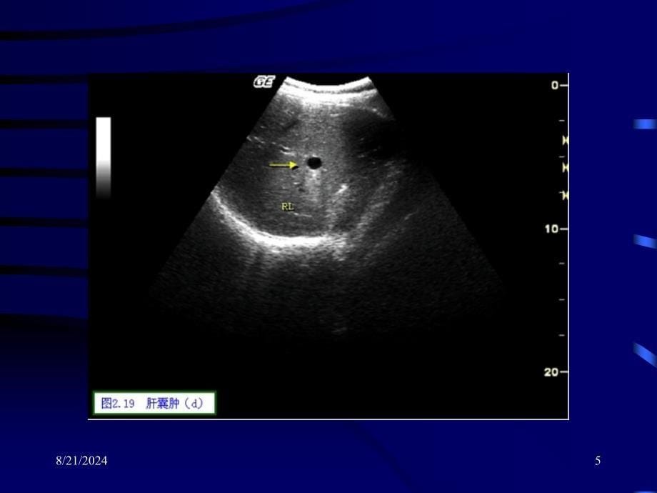 最新超声诊断学基础PPT文档_第5页