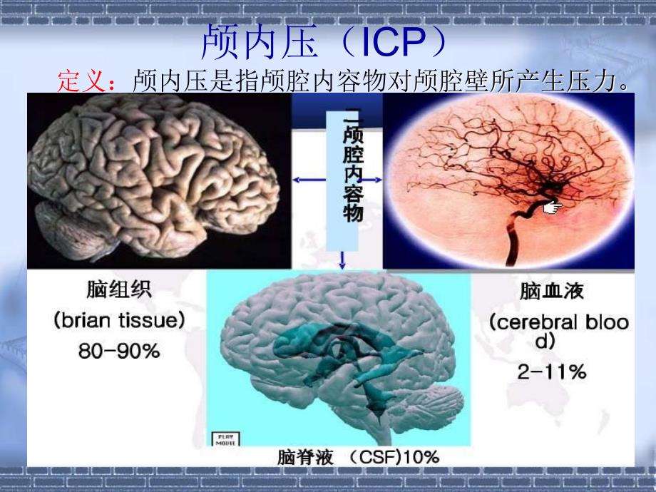 颅内压增高病人的护理1_第2页