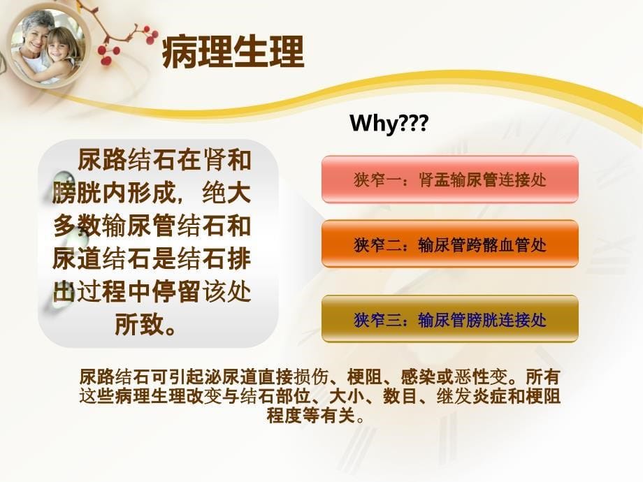 输尿管结石患者的护理查房_第5页