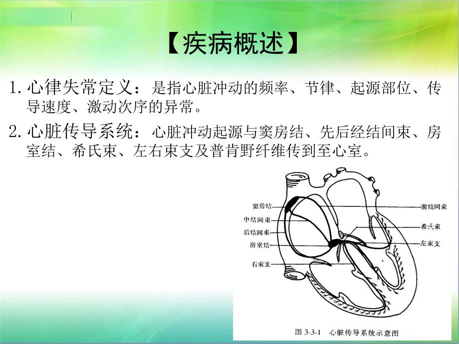 心律失常病人的护理查房_第2页