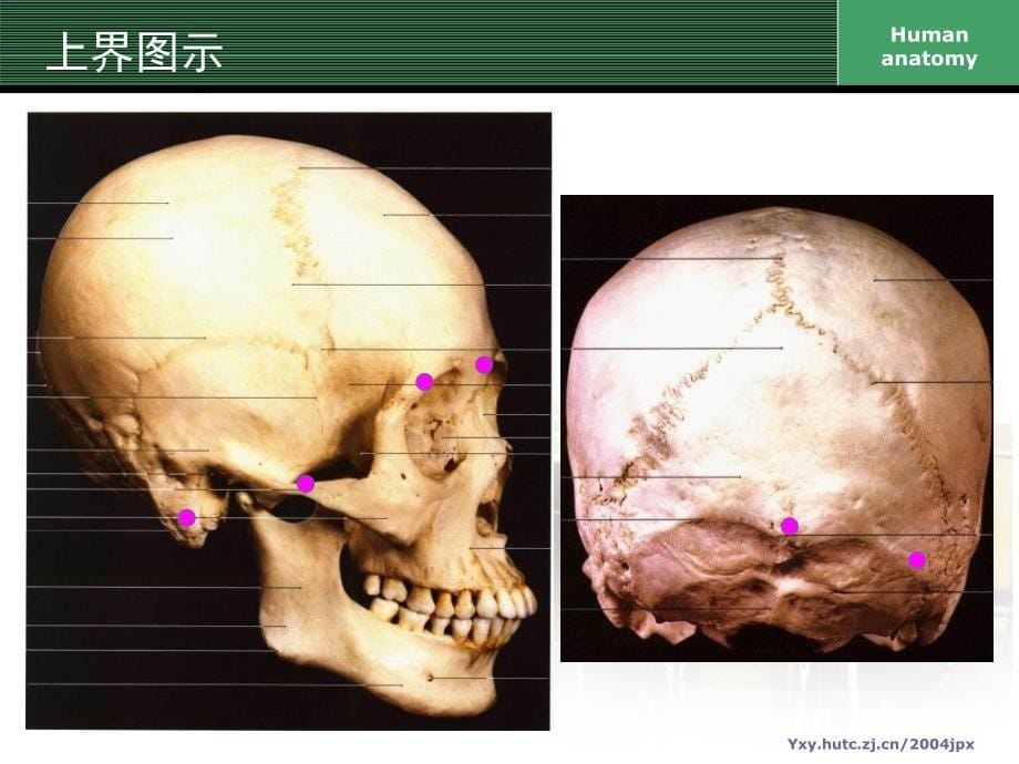 分离颅骨PPT课件_第5页