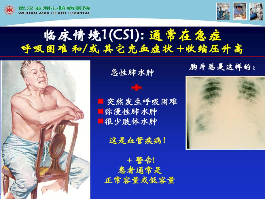 急性心力衰的竭的管理ppt课件_第4页