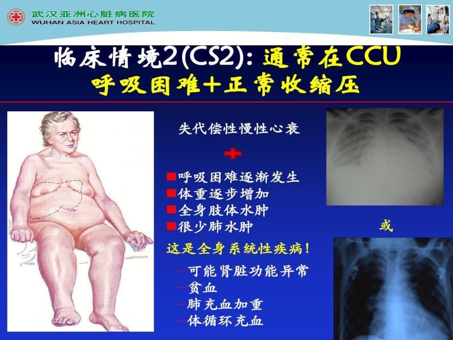 急性心力衰的竭的管理ppt课件_第5页