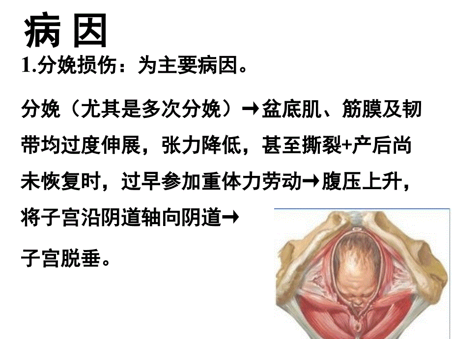 子宫脱垂病例探讨_第4页