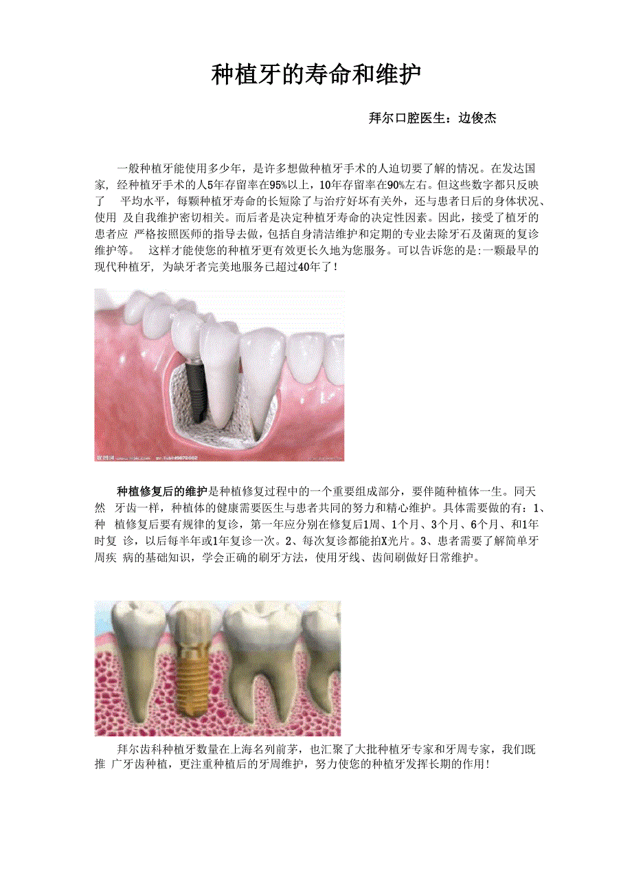 种植牙的寿命和维护_第1页