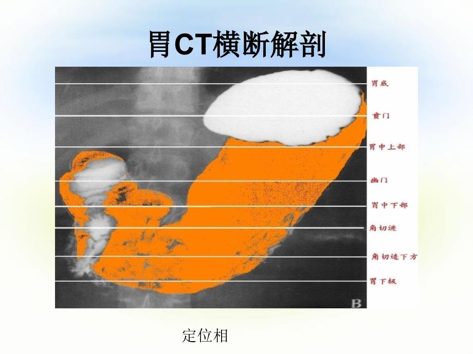 正常腹部CT解剖_第3页