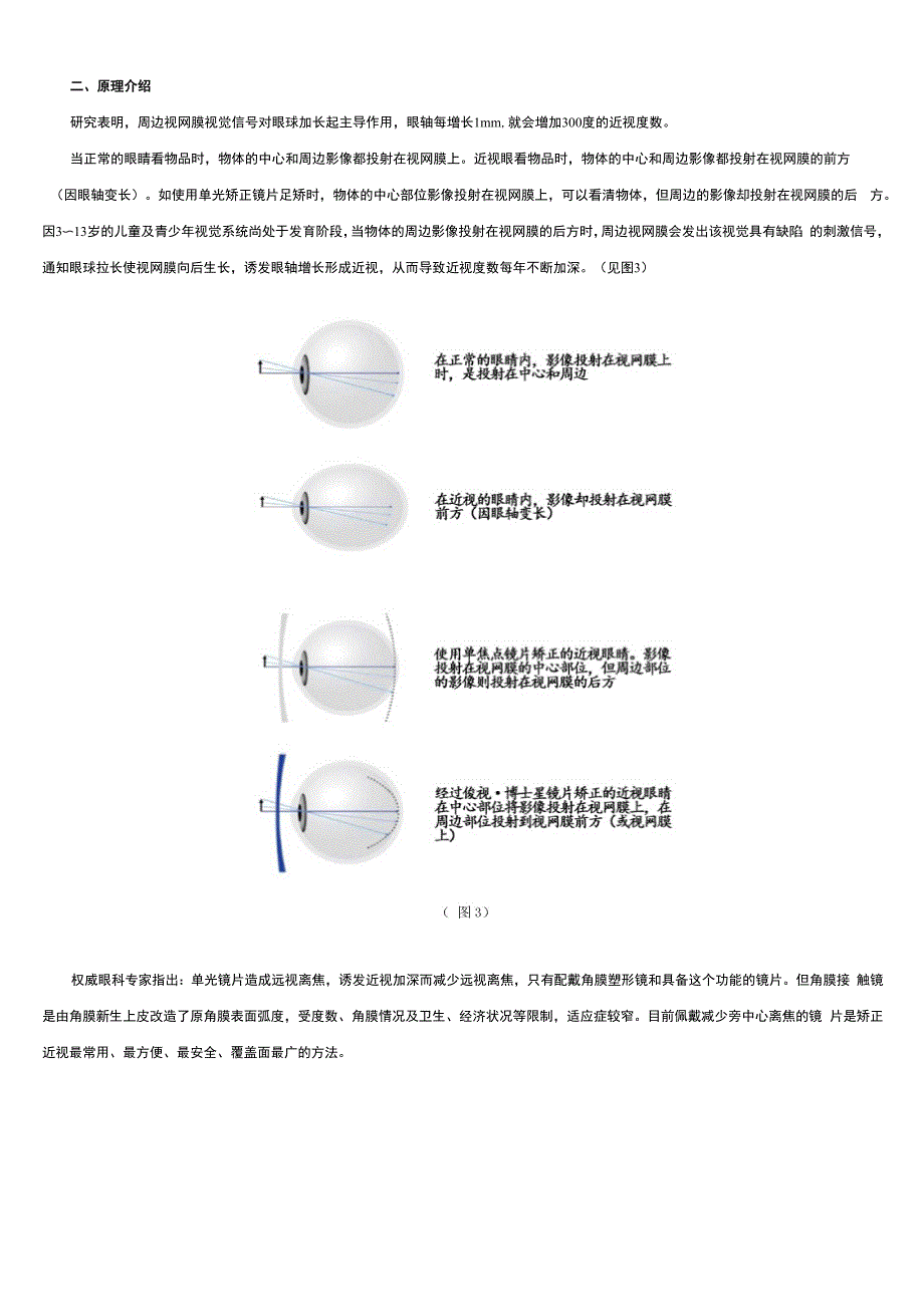 离焦、全焦、环焦镜片的区别_第2页