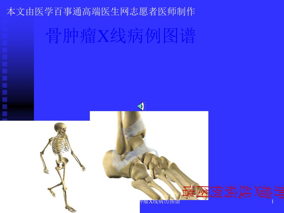 骨肿瘤X线病历图谱课件_第1页