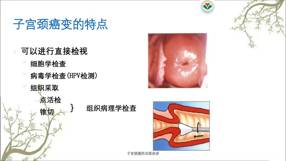 子宫颈癌防治现状讲_第4页