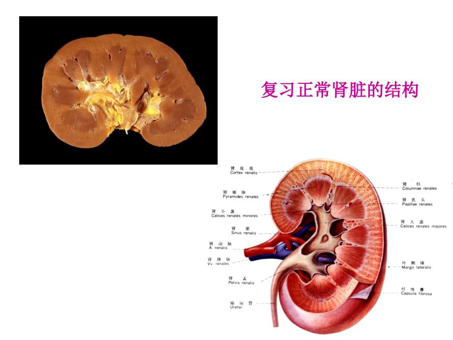 病理学-肾小球肾炎(上部分)_第3页