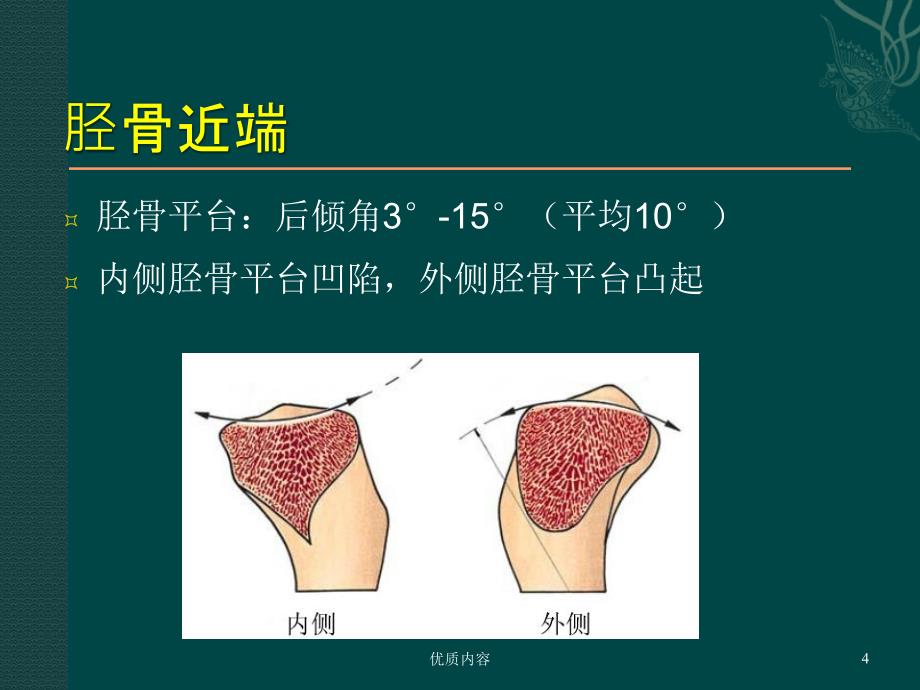 膝关节前交叉韧带损伤的诊疗参考材料_第4页