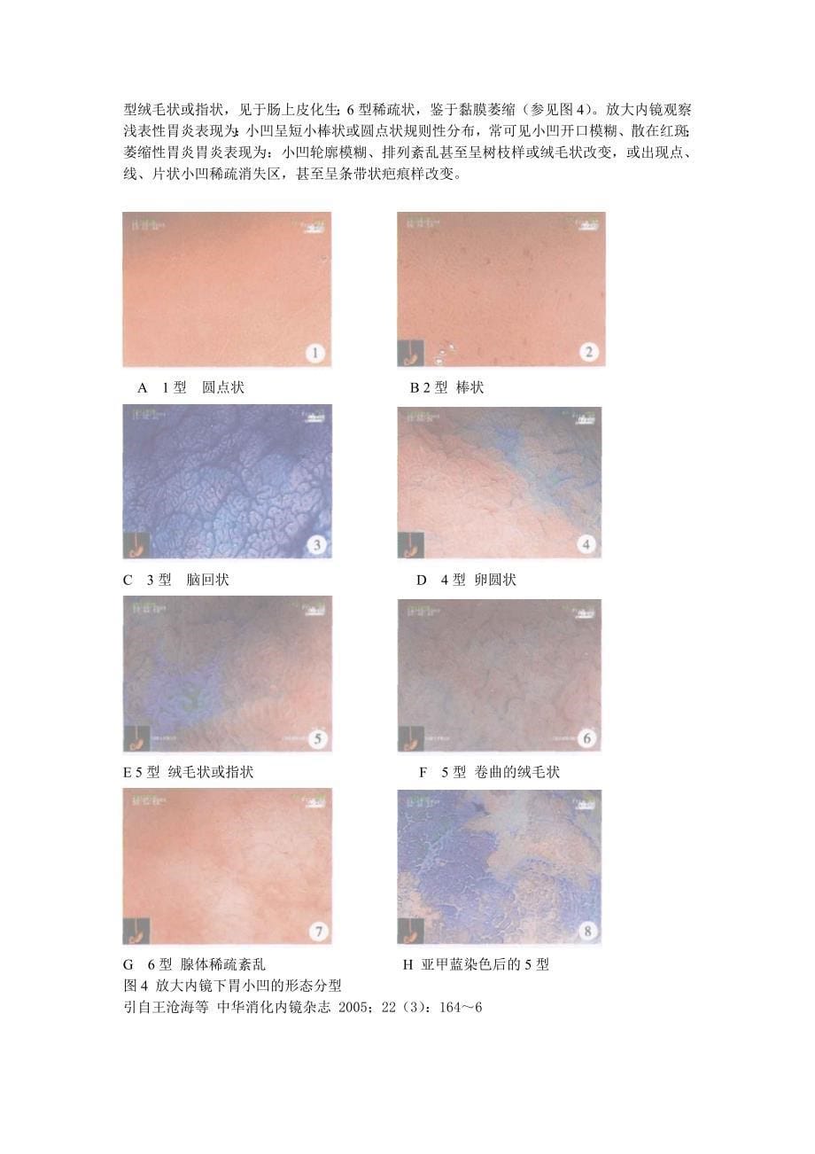 放大内镜、色素内镜.doc_第5页