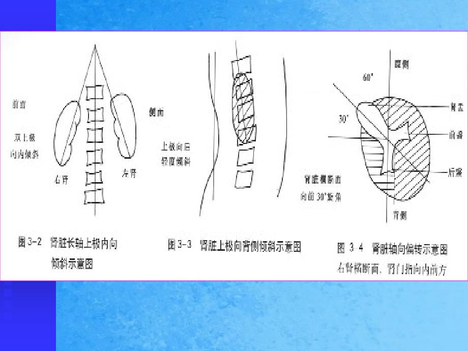 肾脏标准切面ppt课件_第3页