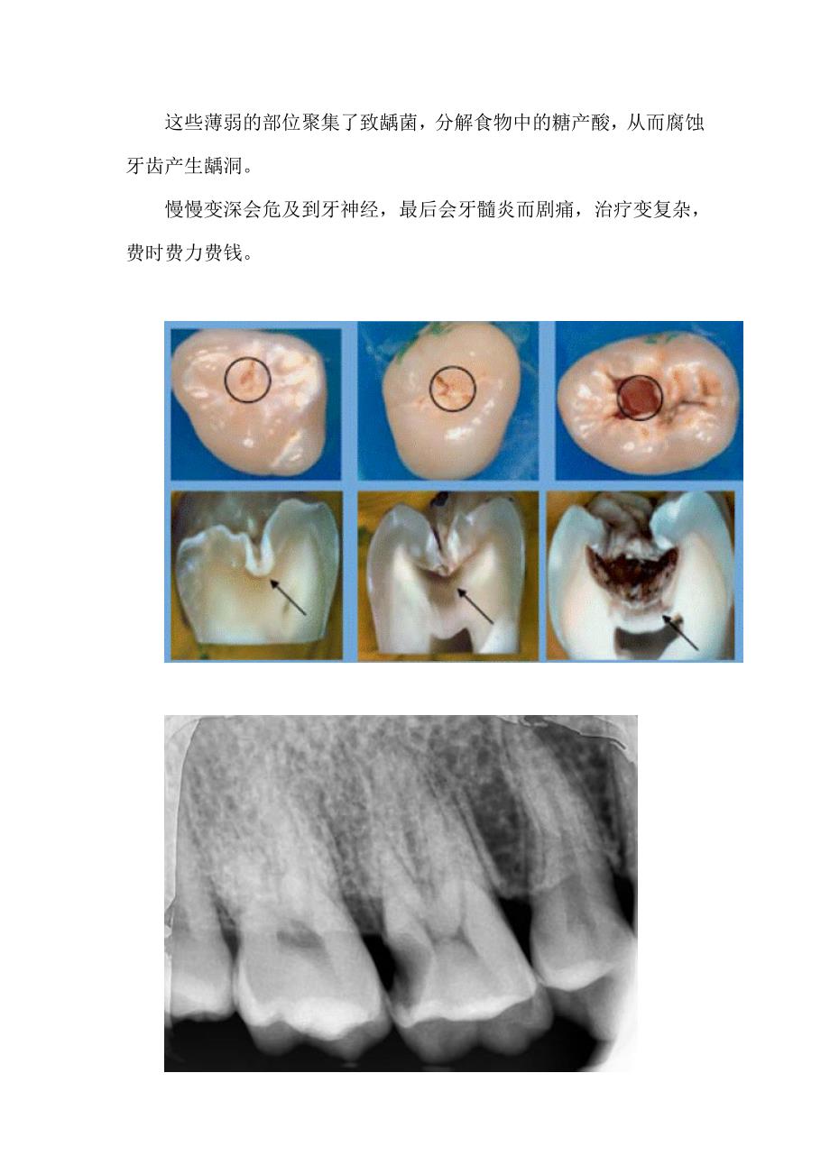 口腔常见问题分析.doc_第3页