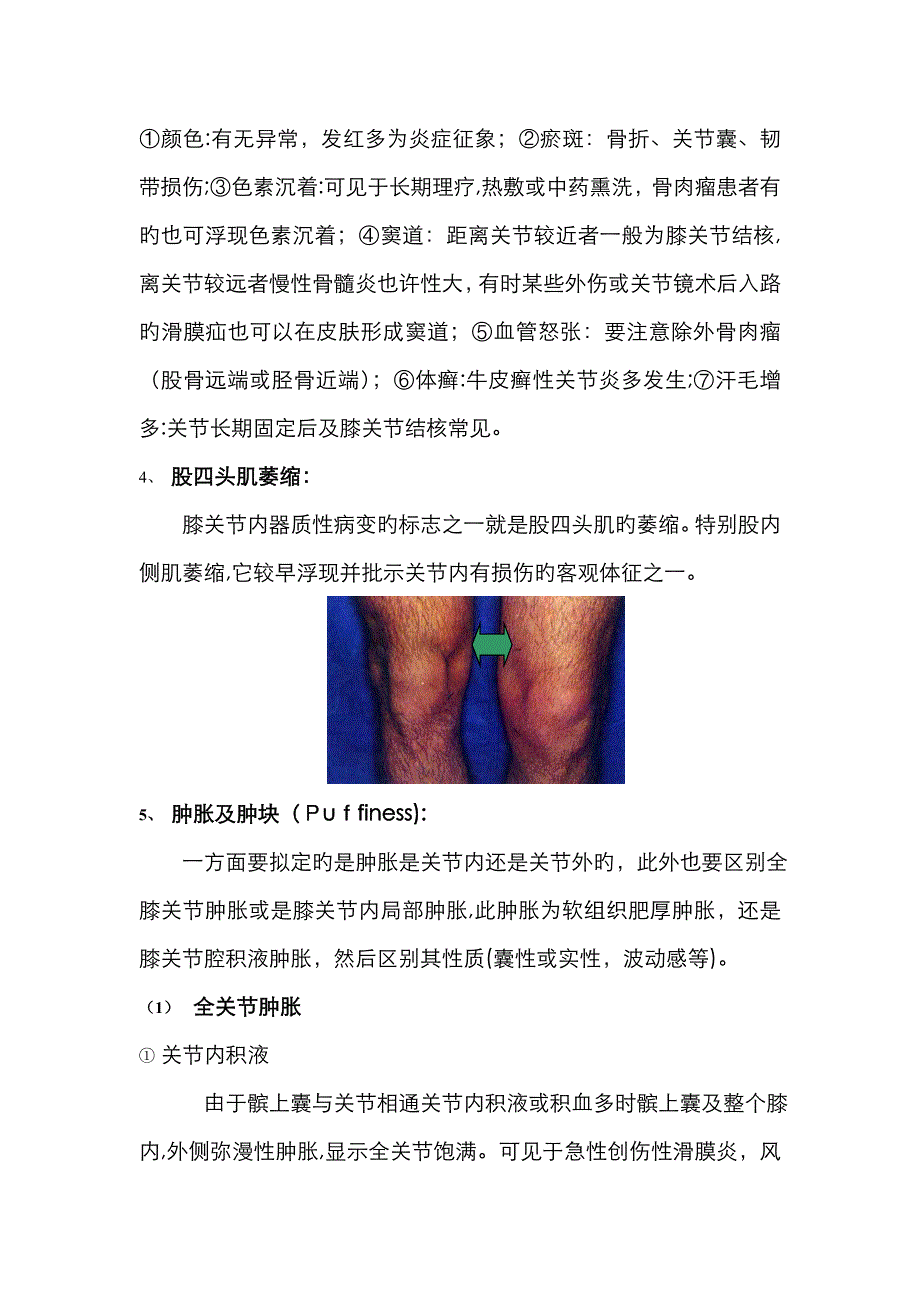 膝关节检查法_第4页