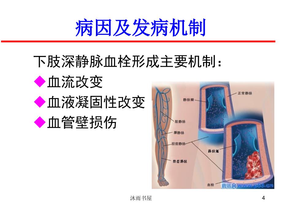 妇科手术后下肢静脉血栓[智囊书屋]_第4页