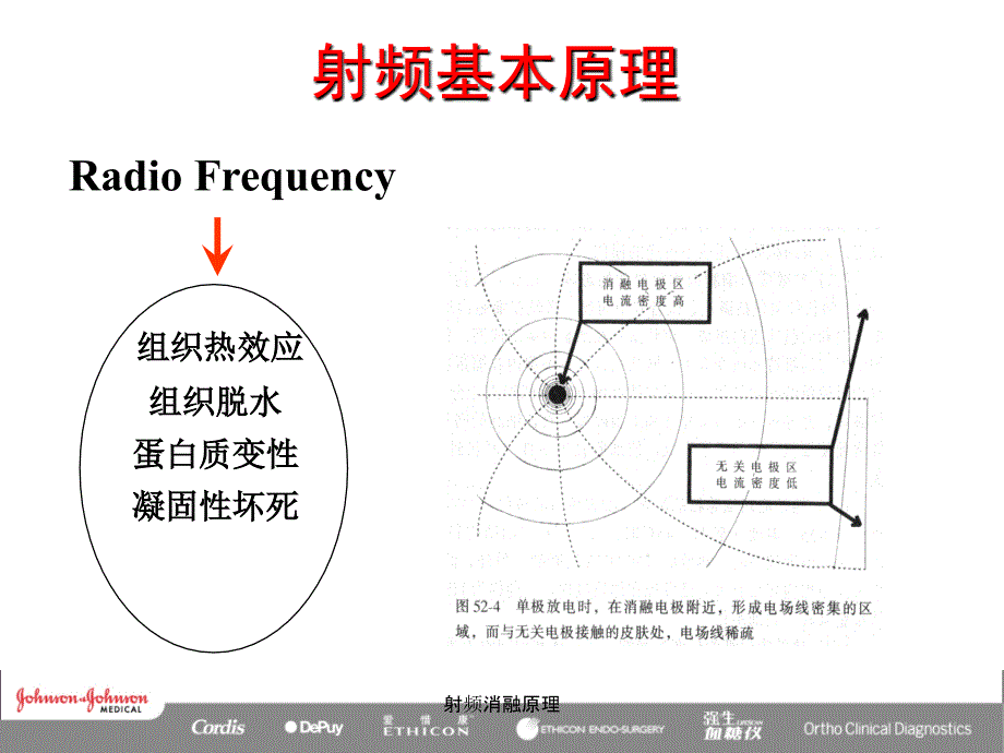 射频消融原理课件_第4页