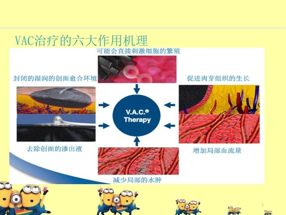 VAC的使用及护理观察要点PPT参考课件_第5页