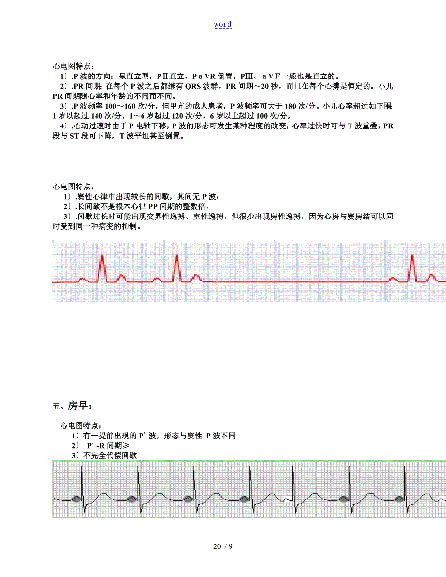 常用20种异常心电图及其特点_第2页