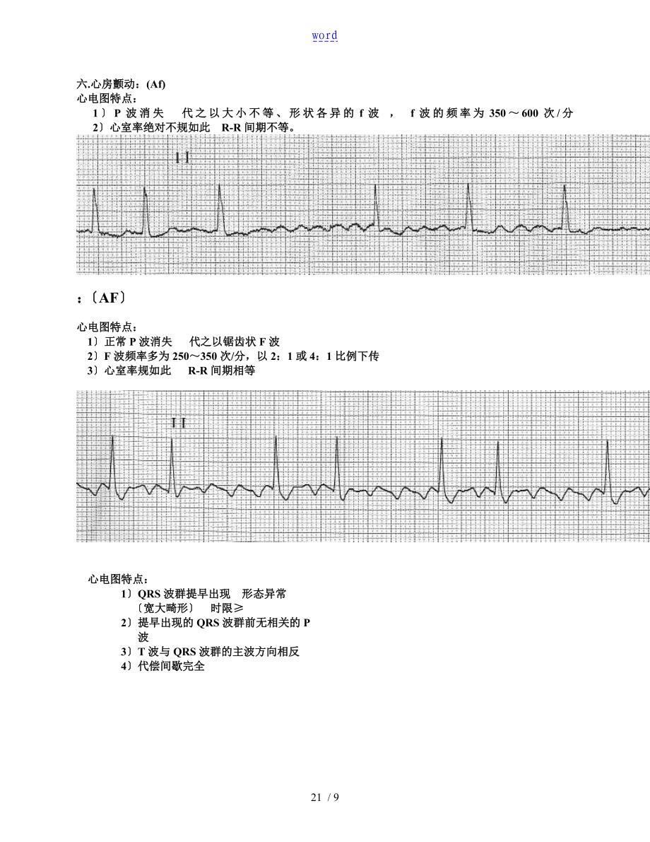 常用20种异常心电图及其特点_第3页