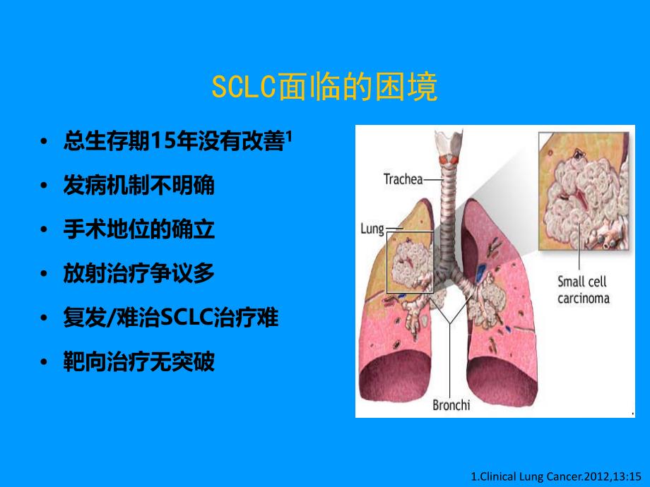 CSCO小细胞肺癌PPT课件_第2页