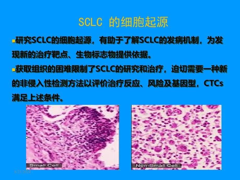 CSCO小细胞肺癌PPT课件_第5页