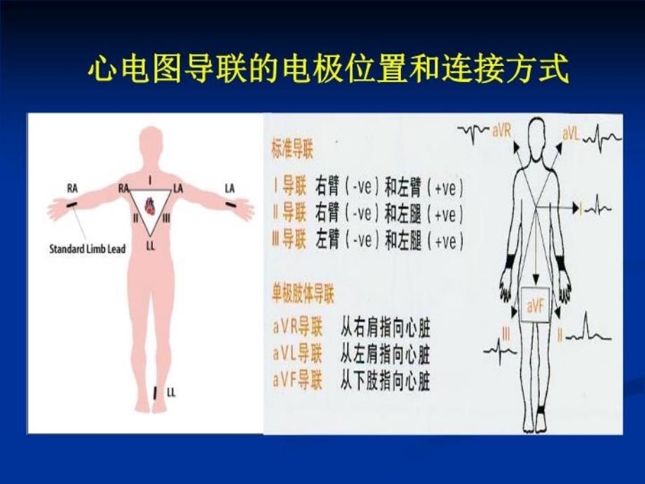 最新心电监护仪操作PPT课件_第3页