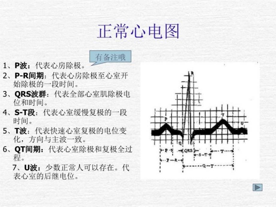 最新心电监护仪操作PPT课件_第4页