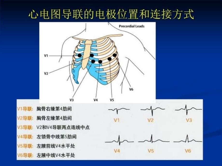 最新心电监护仪操作PPT课件_第5页