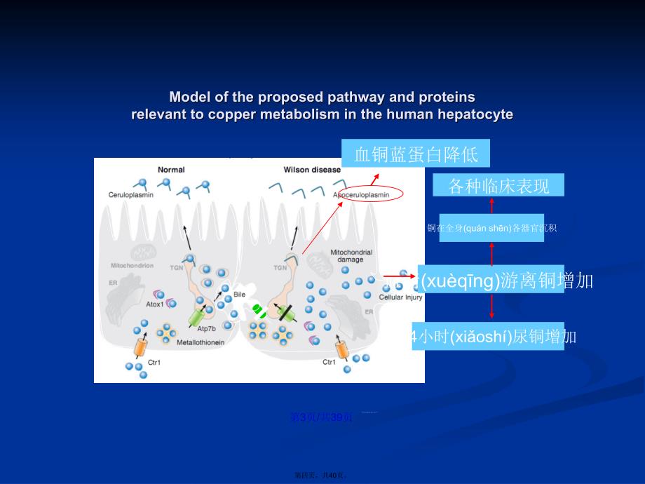 wilson病的诊断治疗学习教案_第4页