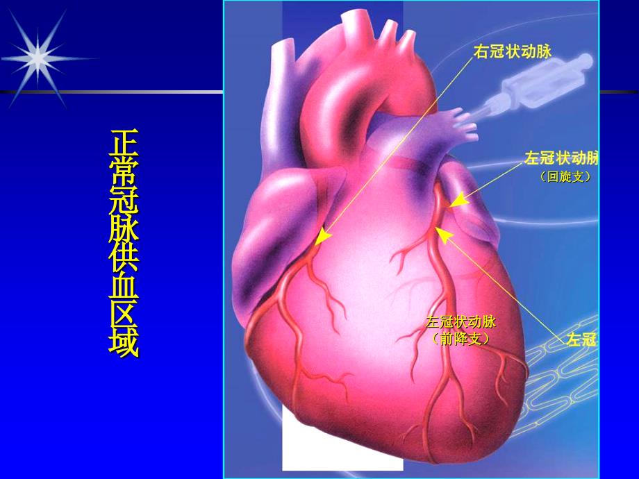 冠状动脉粥样硬化性心脏病比赛_第2页