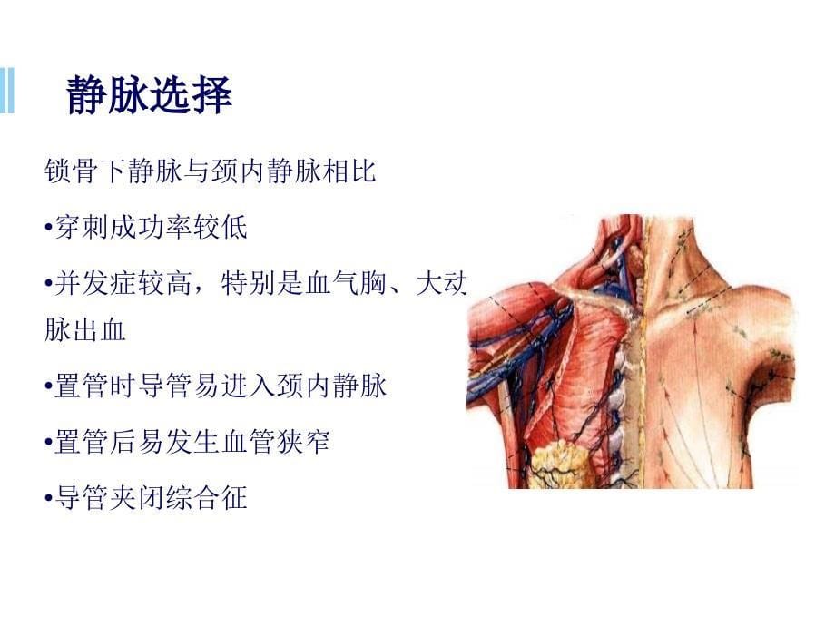 port植入常见问题及处理ppt参考课件_第5页