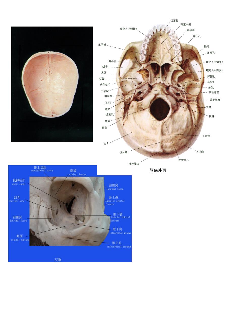 颅骨连接及新生儿颅骨特点.doc_第3页