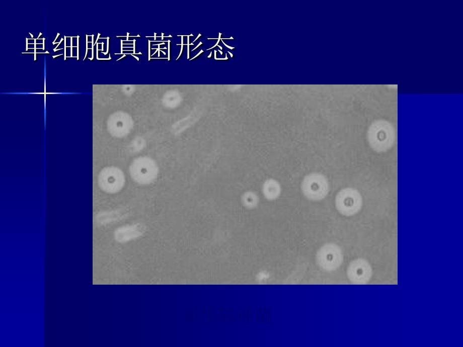 医学课件真菌Fungus课件_第5页